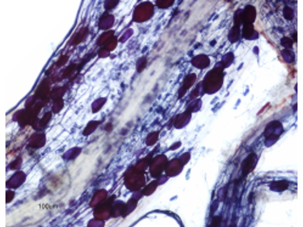 AMF spore cluster, trypan blue stain
