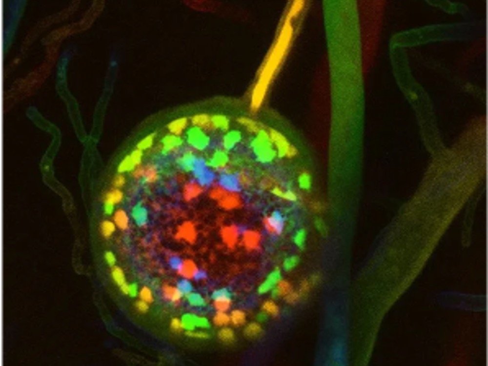 Fluorescent root colonization image